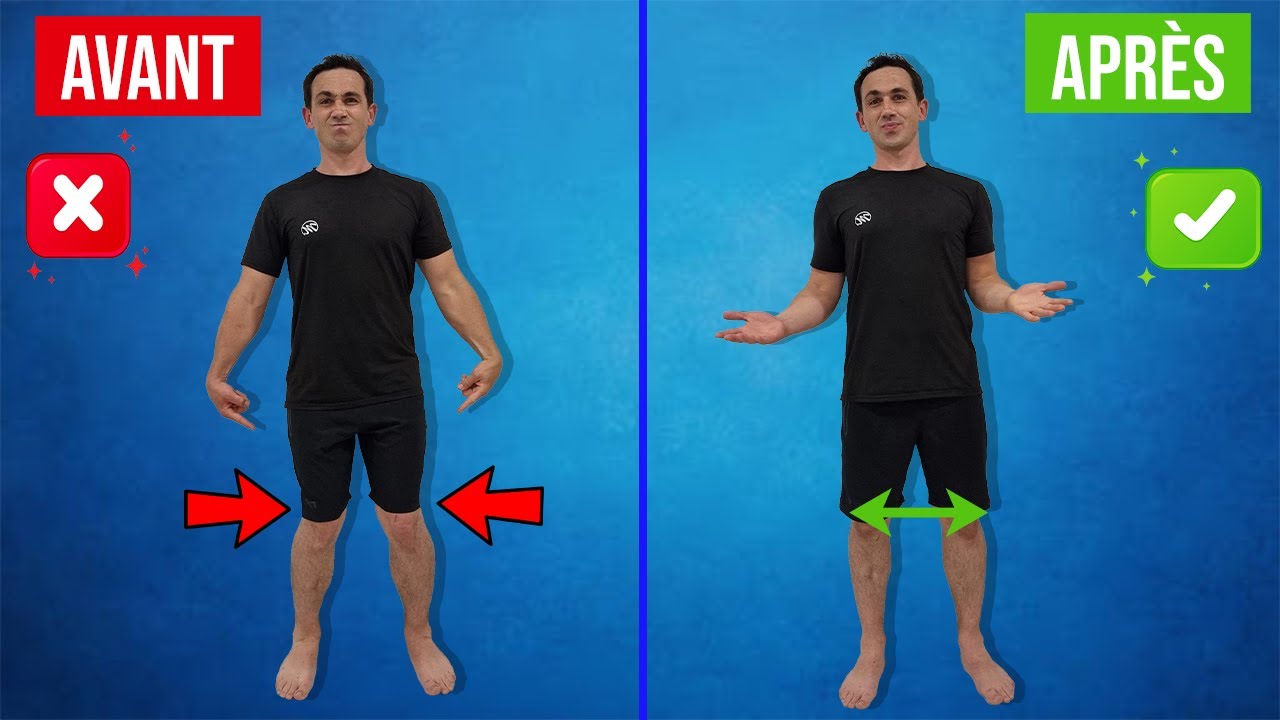 Corriger les GENOUX en X (Genu Valgum) : Exercices Kiné